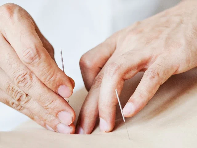 Massage In Kingston, London - New Open Acupuncture &