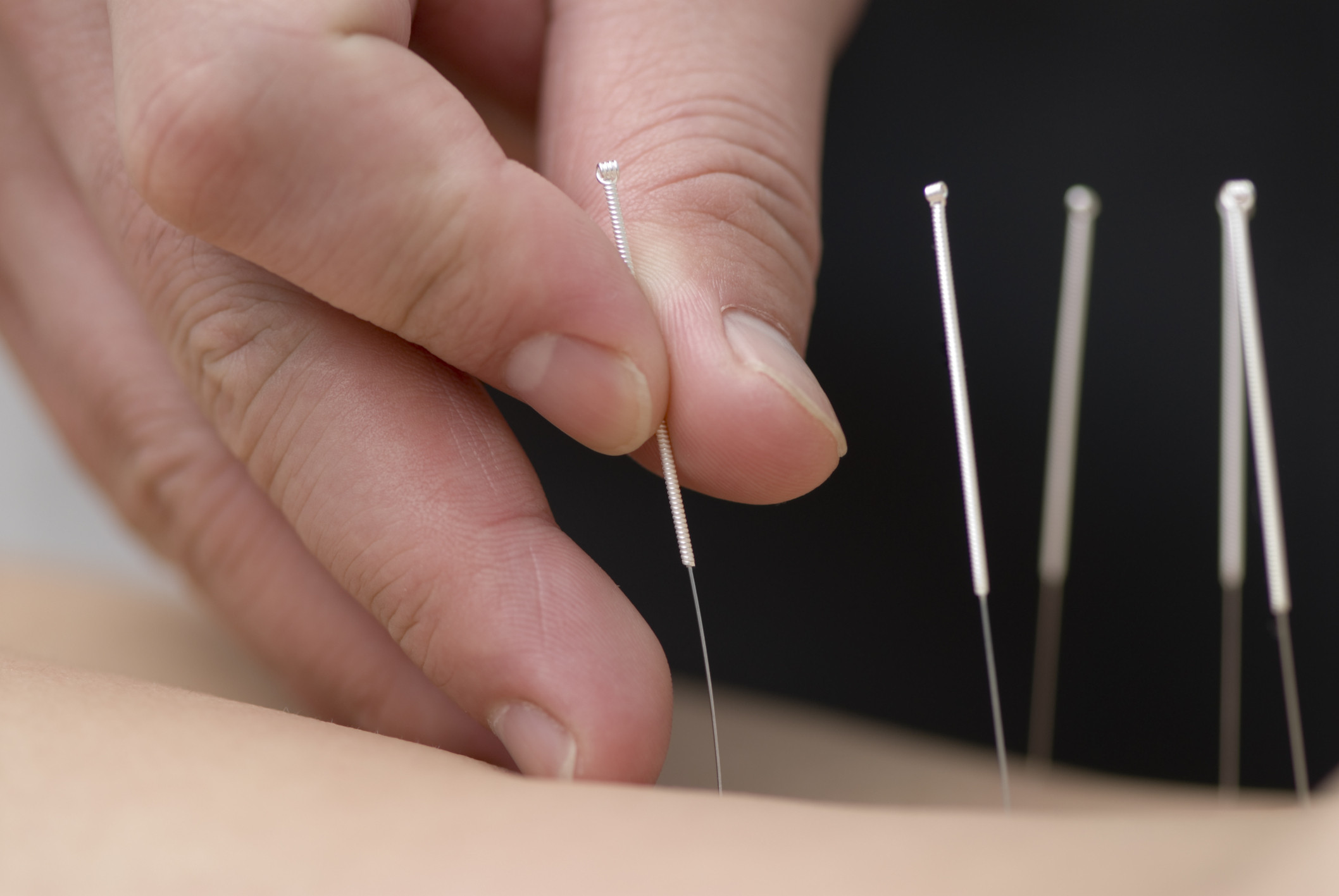 Massage, Acupuncture, Herbal In Loughton, Essex