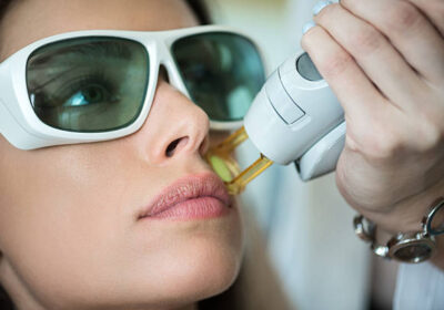 Laser-Hair-Removal-in-Riyadh-11