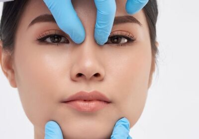 Rhinoplasty-Surgery5