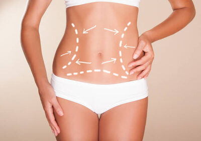 Liposuction-surgery-in-Riyadh-22