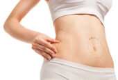 Liposuction in Riyadh